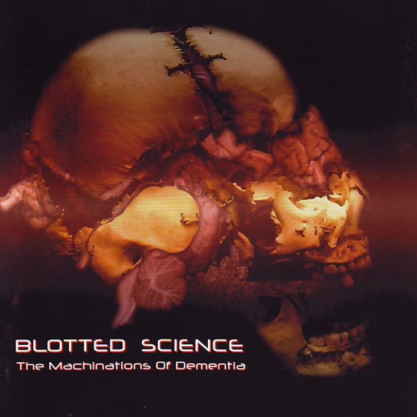 The Machinations Of Dementia